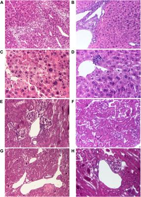 Study on Acute Toxicity of Amiodarone New Complexes With Cyclodextrin